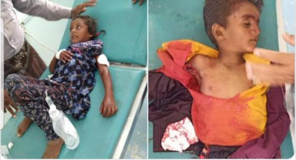 استشهاد طفل وإصابة شقيقته بقصف حوثي على التحيتا 