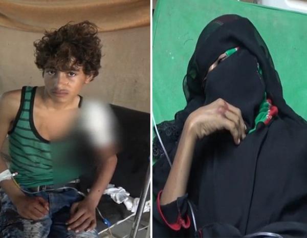 الحديدة.. استشهاد وإصابة 4 مدنيين بينهم طفلة برصاص قناصة الحوثي